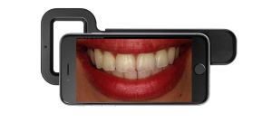 Adapter voor Smile Capture